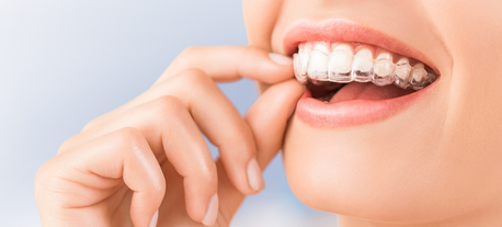 Braces vs Invisalign: Which Treatment Is Right for You?